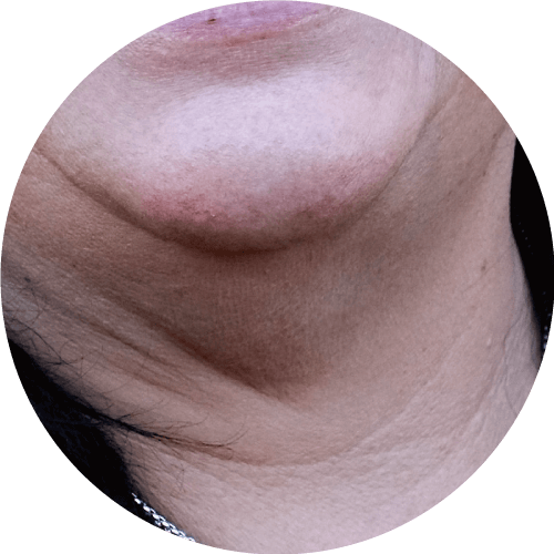 影響顏值