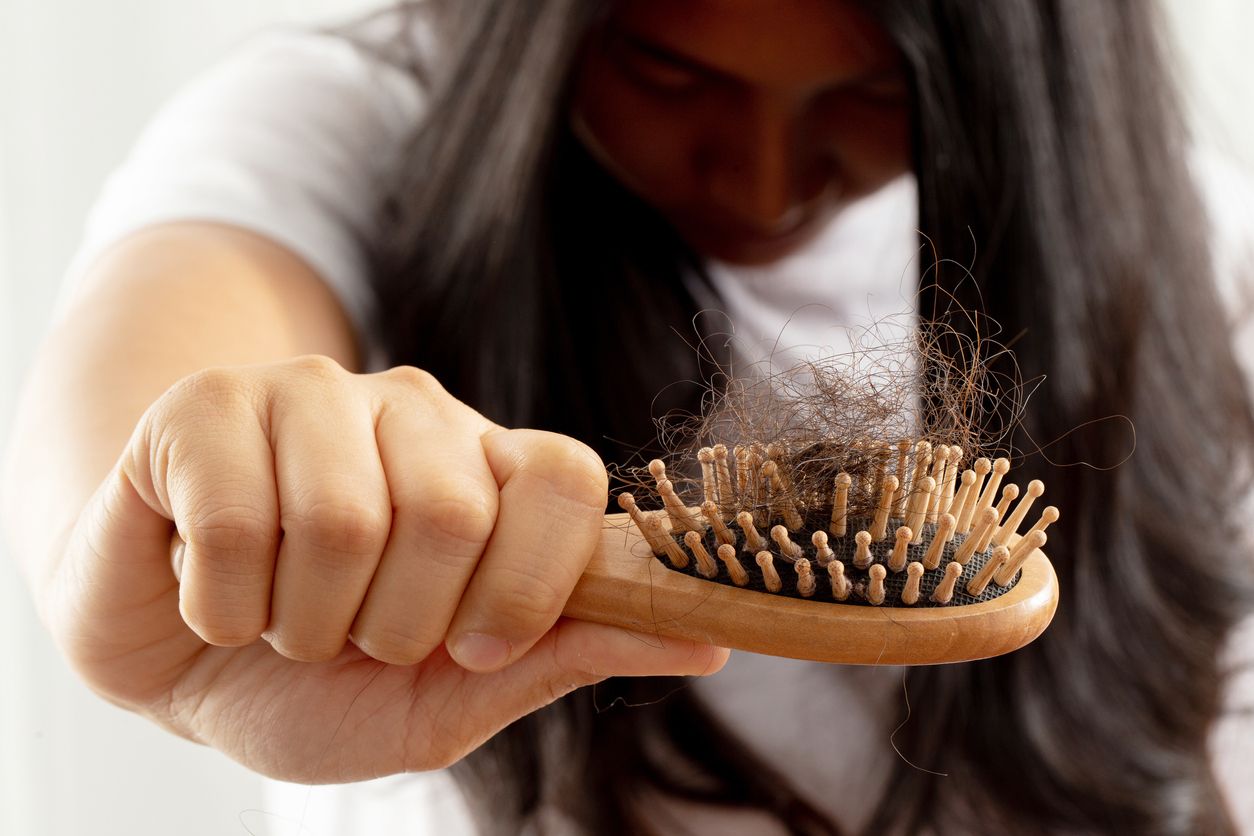 【掉頭髮缺什麼？】狂甩頭髮是身體發出警號！科學拆解毛囊需要的6大營養 