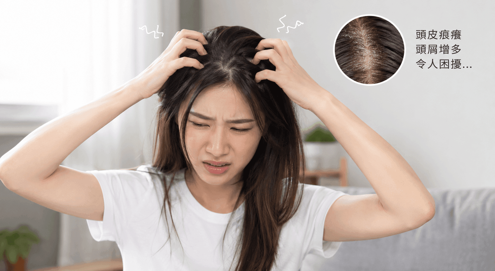 天天洗頭反而越洗越痕？揭開「頭皮痕癢原因」，原來這步你一直做錯！