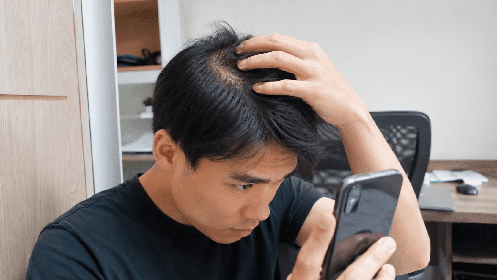 地中海禿頭年齡提前到25歲？最快3年就禿，打工仔5招救髮！