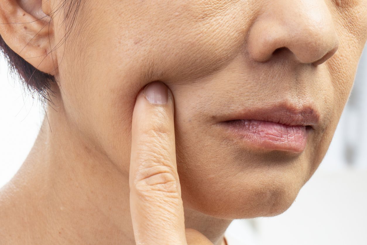 透明質酸功效指南：保濕、注射填充與去虎紋療程點揀好？