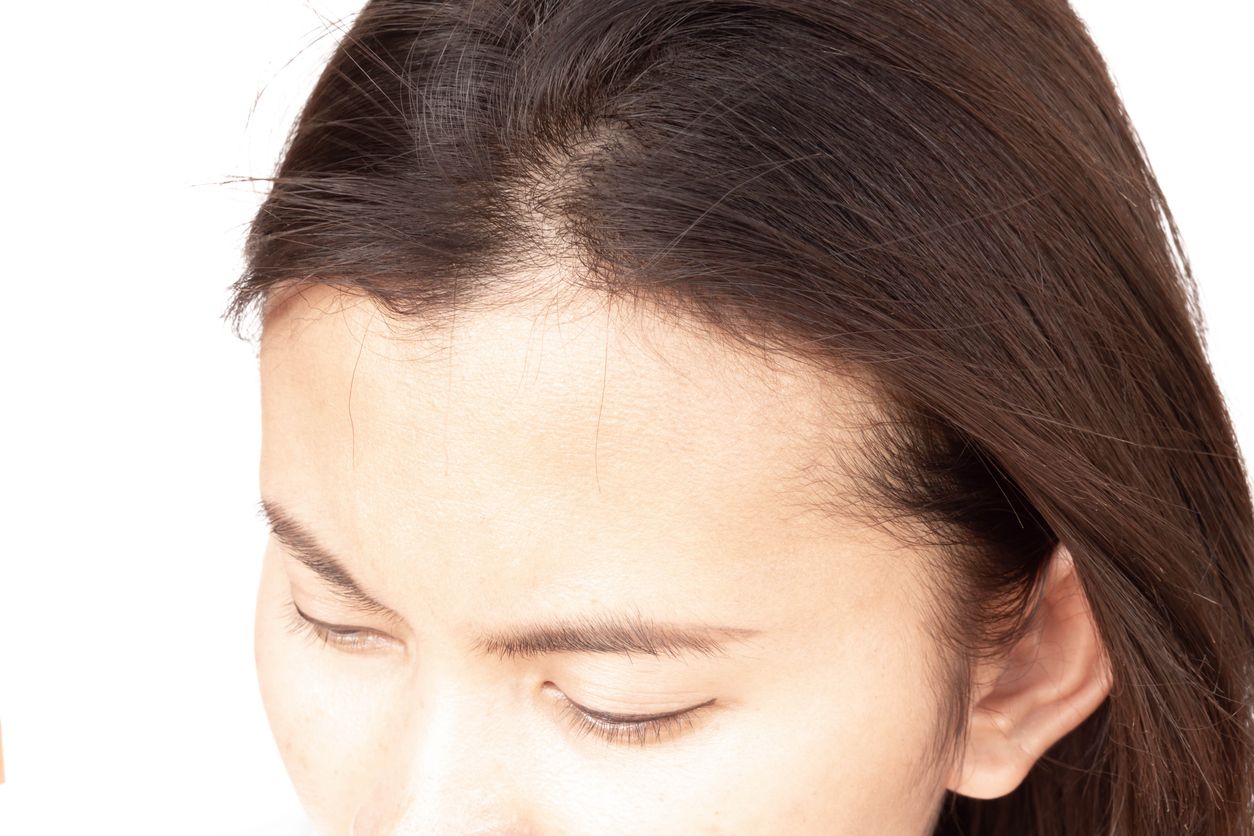 7個超有效生髮方法，90%的人都忽略了這一點？「這一步」竟然是防脫髮關鍵！