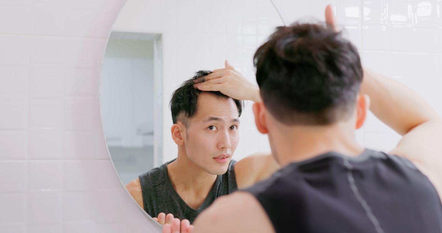 美人尖面相代表好運？即看4大真假特徵！做錯1步隨時引爆禿頭危機？