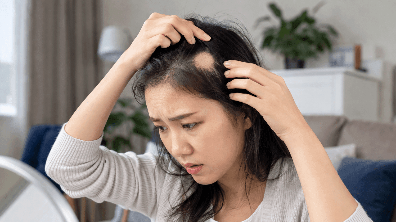 什麼是斑禿？3分鐘解開「鬼剃頭」的恐怖迷思，原來90%患者都有這個共通點！