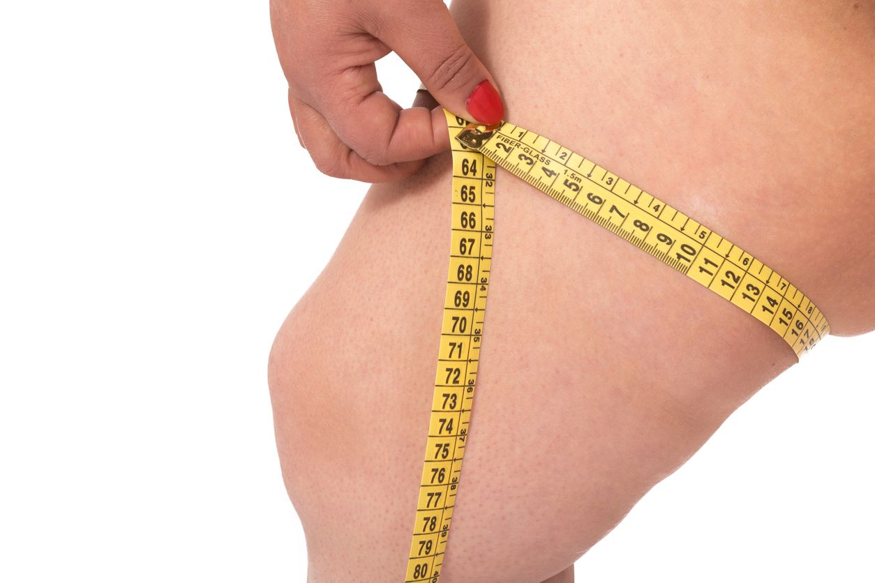 如何有效美腿：解析8大腿粗原因+日常改善生活6招推介 全面擊退肥胖象腿！