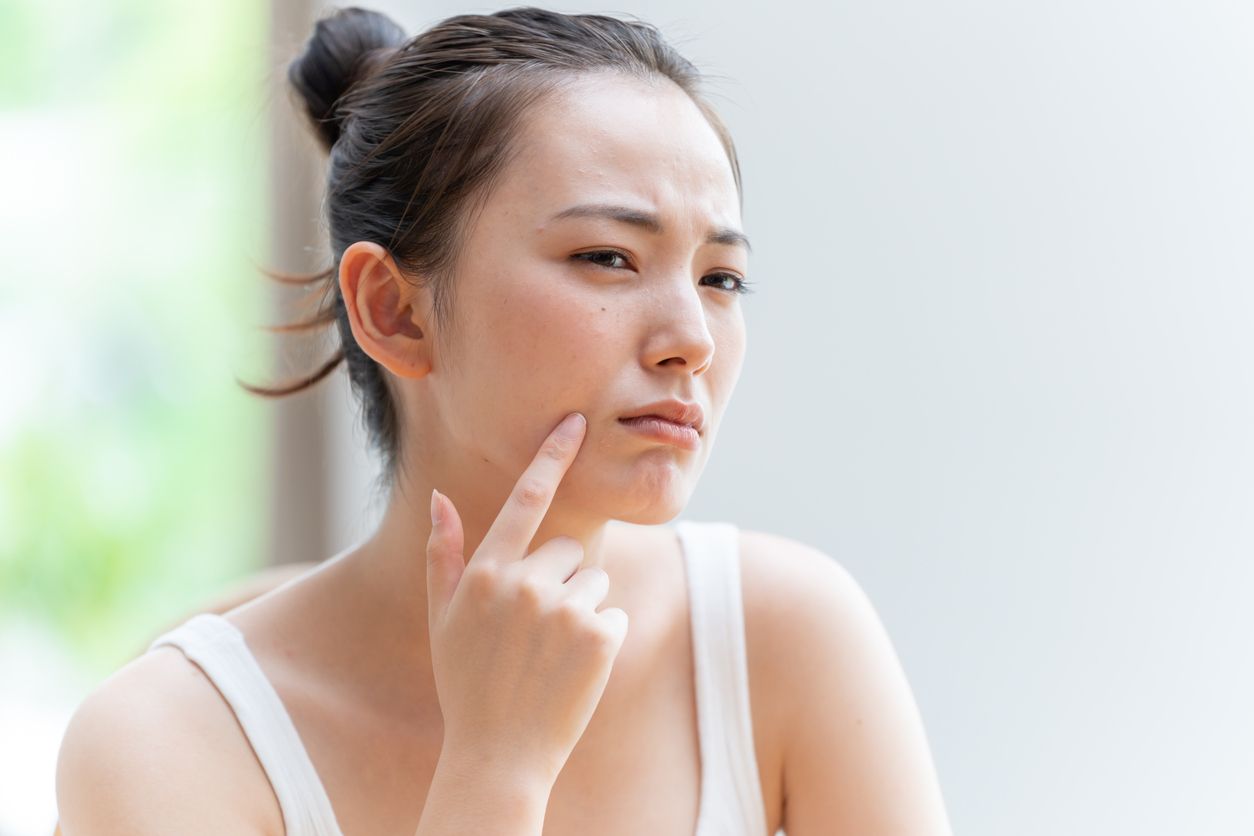 消除法令紋價錢及方法一覽：射頻、HIFU、Fotona 4D 虎紋槍、透明質酸針等