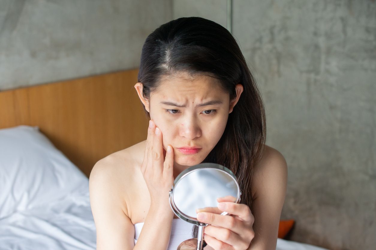 黑眼圈類型全攻略：如何辨別血管型、色素型或結構型？3 招自我檢測辨認黑眼圈類型 ！