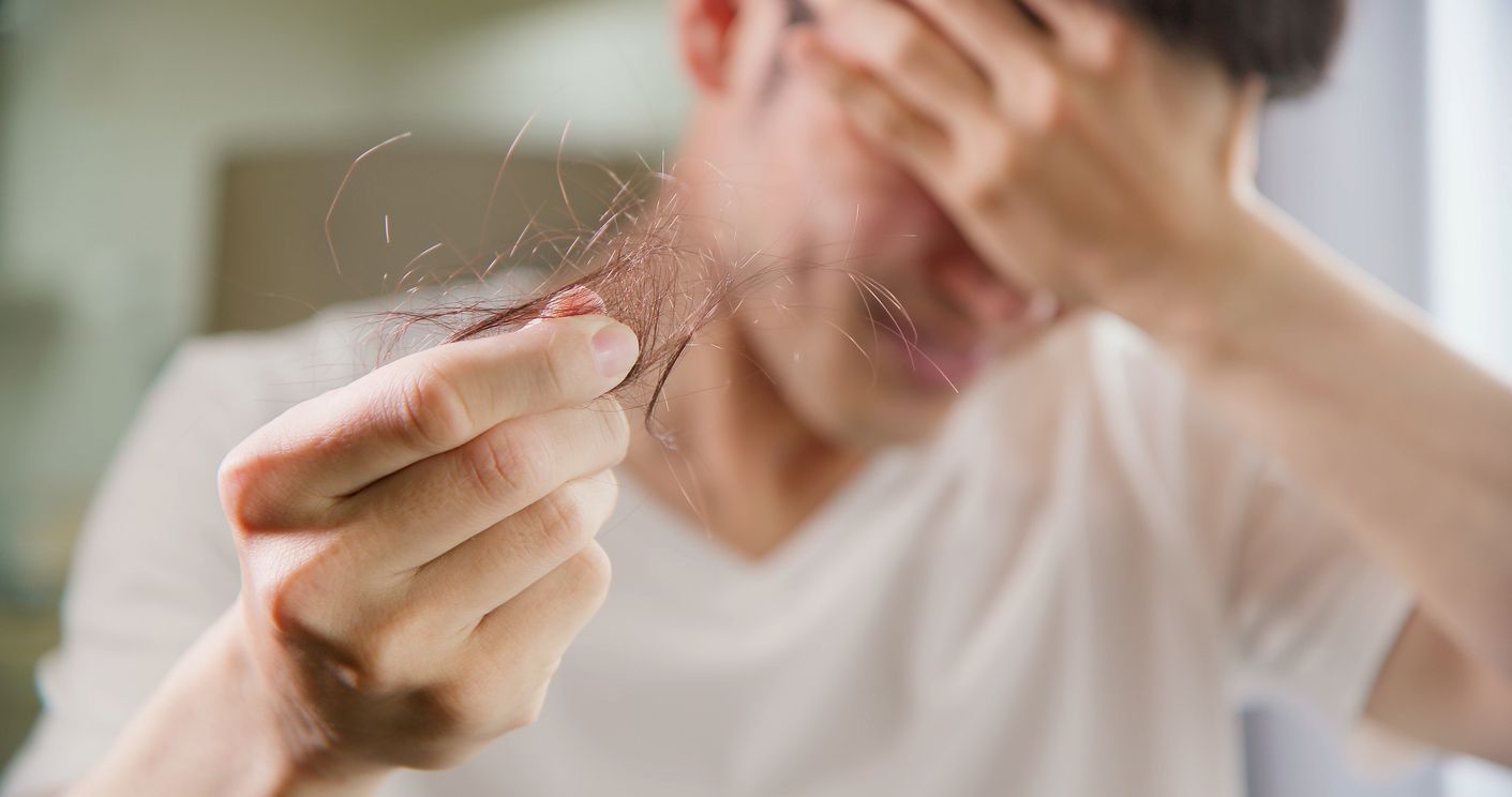 男士脫髮自救指南：M字額只能剃光頭？一文看清脫髮6大成因，1招極速重拾濃密髮量！ 