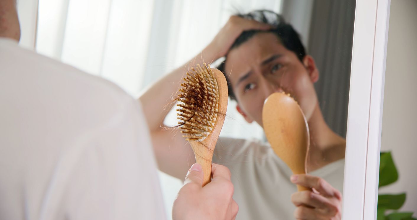 男士防脫髮必讀大全：認清5大甩頭髮原因！盤點4大生髮治療方案