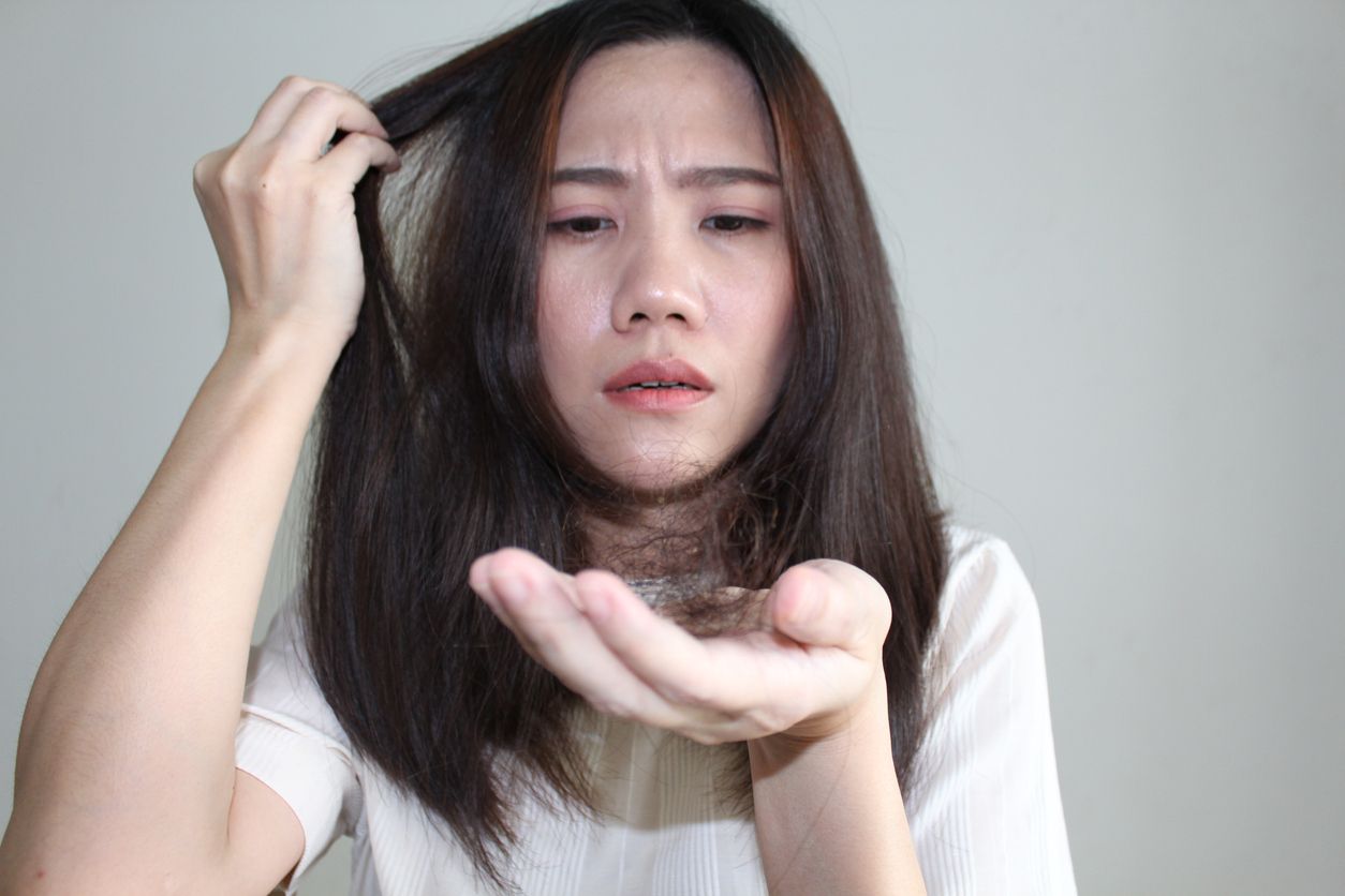 如何判斷禿頭？每天掉髮是警號？一文看懂5大前兆，1招逆轉脫髮危機！