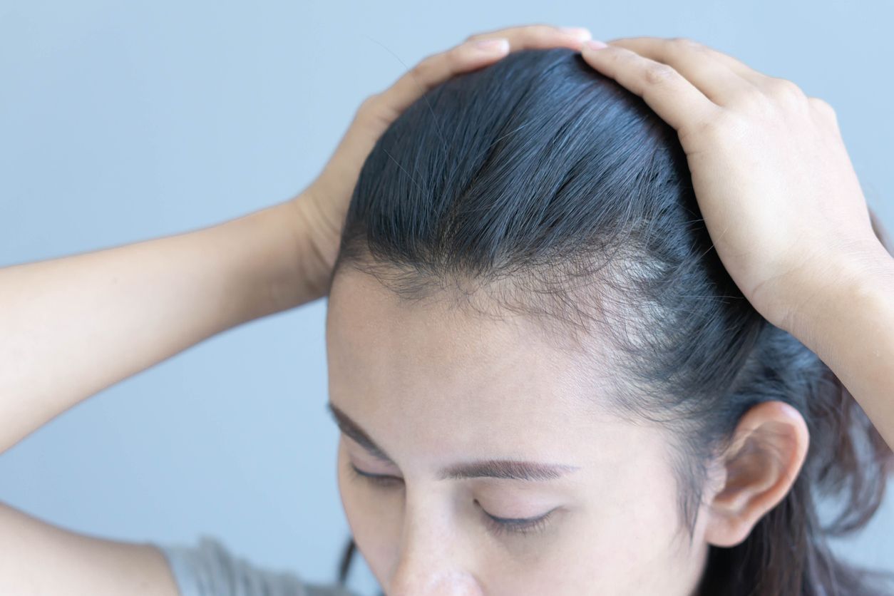 髮際線高點算好？額頭四指寬即變「清朝阿哥」？1招自測+7個修飾高髮線的髮型