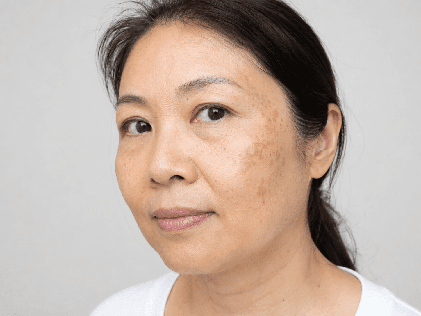 【老人斑】手背、臉頰突然多了幾塊「粗糙污點」？對照這篇，看你是不是中了最難搞的老人斑