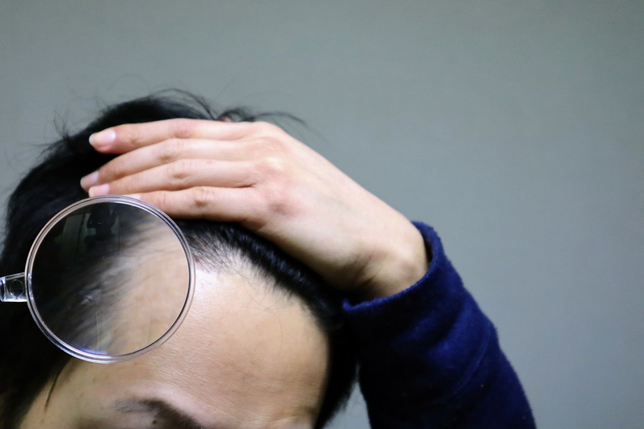 男士脫髮問題沒救了？拆解3大隱藏成因！90%雄性禿都有救？揭開專業醫師不說的生髮關鍵