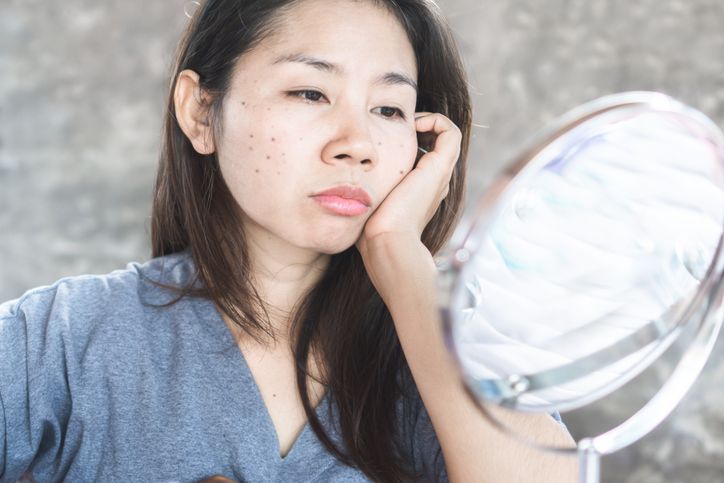 更年期前的女士