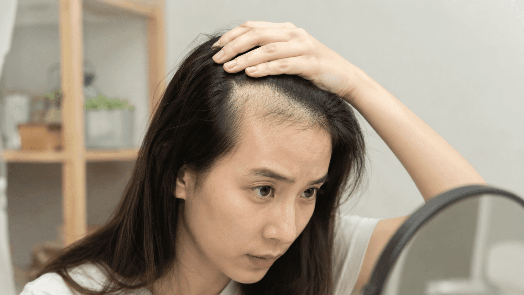 前額脫髮髮型：推薦4款女士前額禿髮型，遮蓋高額頭、修飾額角不顯老！