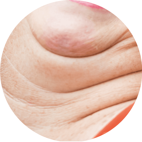 下巴變得浮腫