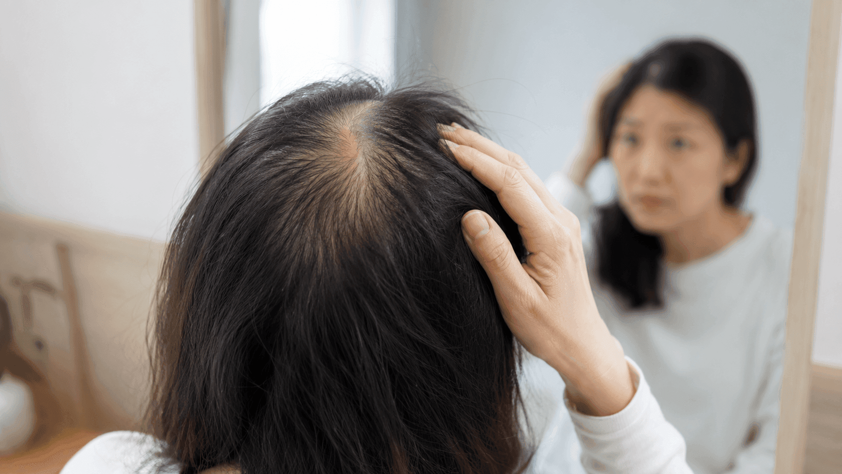 髮旋禿 V.S. 正常髮旋點分？醫生教你自測：5大隱藏髮旋禿症狀，錯過黃金期恐永久脫髮！