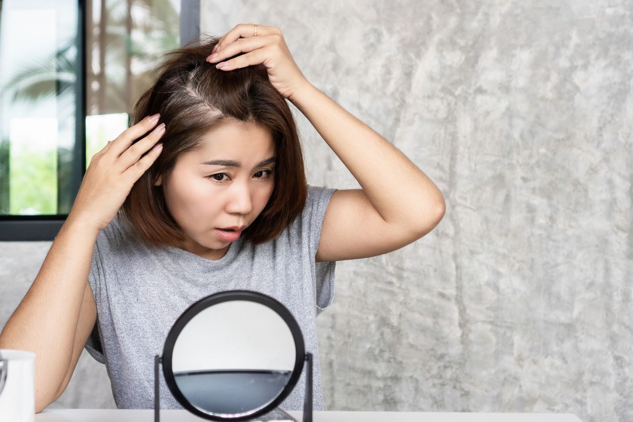 為什麼吃A酸會脫髮？停藥後頭髮真的能長回來嗎？即學4招活髮招數！